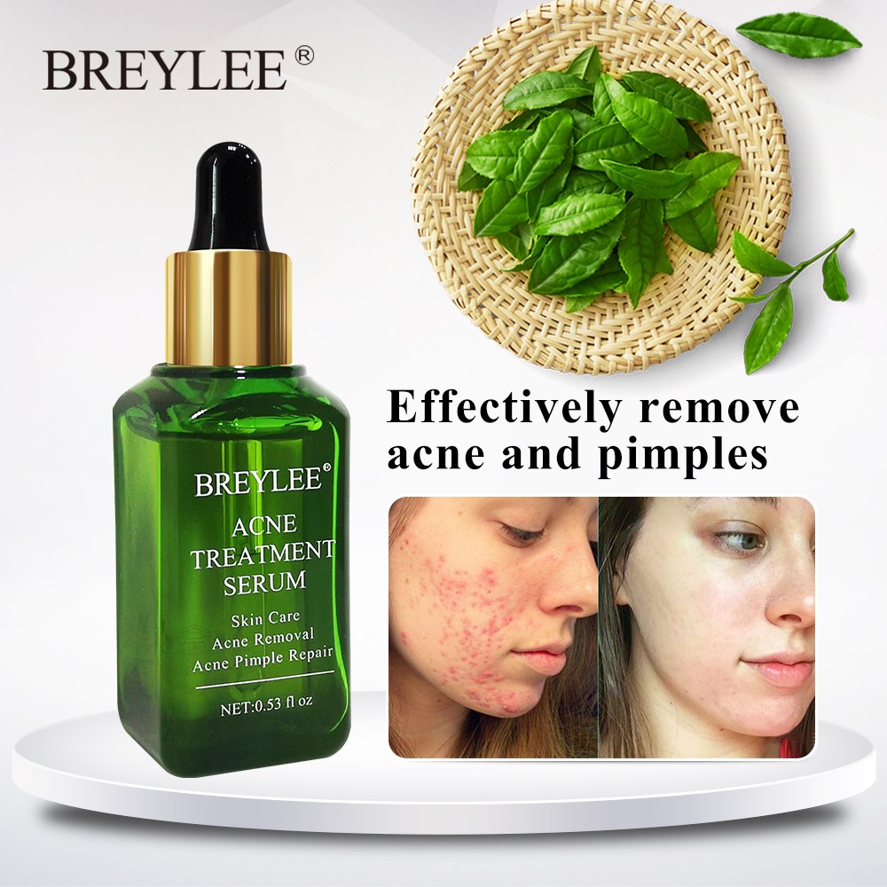 BREYLEE Acne Treatment Serum Face Facial Essence Anti Acne Scar Removal Cream Skin Care Whitening Repair Pimple Remover For Acne
