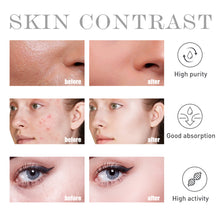 Load image into Gallery viewer, Salicylate Skin Repair Acne Skin Care Water
