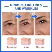 Load image into Gallery viewer, Anti-Wrinkle Essence Firming Head Lifting Pattern French Pattern Fading Wrinkle Botox Essence

