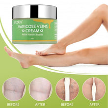 Load image into Gallery viewer, Vein Cream Red Blood Streaks Repair Earthworm Leg Bruises Bulge Relief Pain Safflower Skin care lotion Varicose Cream
