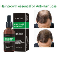 Load image into Gallery viewer, Hair Growth Oil Hair Growth Oil Oem Hair Care Essential Oil
